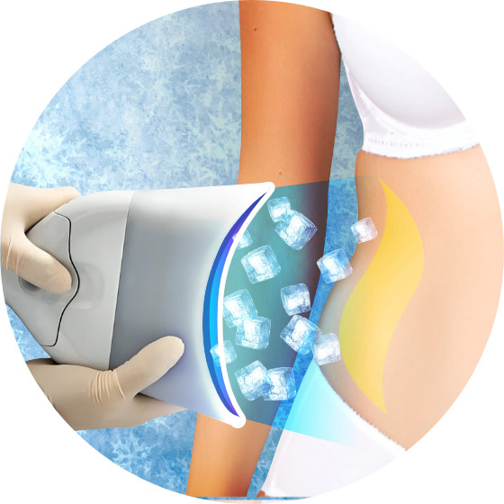 Cryo360